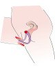 Стимулятор G-точки - G-spot Labia Spreader Стимулятор G-точки - G-spot Labia Spreader