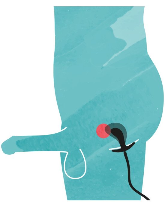 Aufblasbarer Analplug Aufblasbarer Analplug